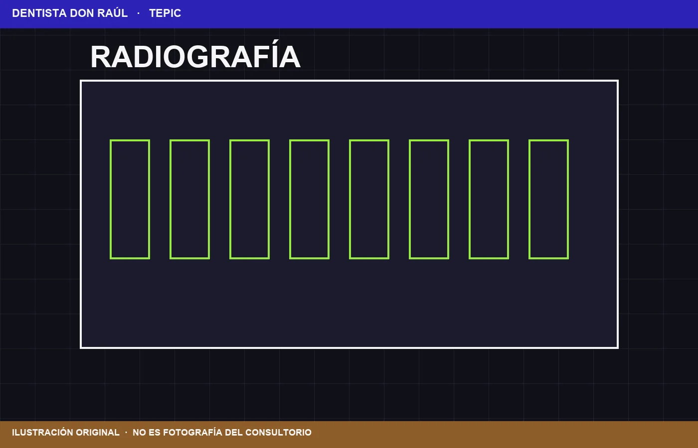 Ilustración de Radiografía periapical. No es fotografía clínica.